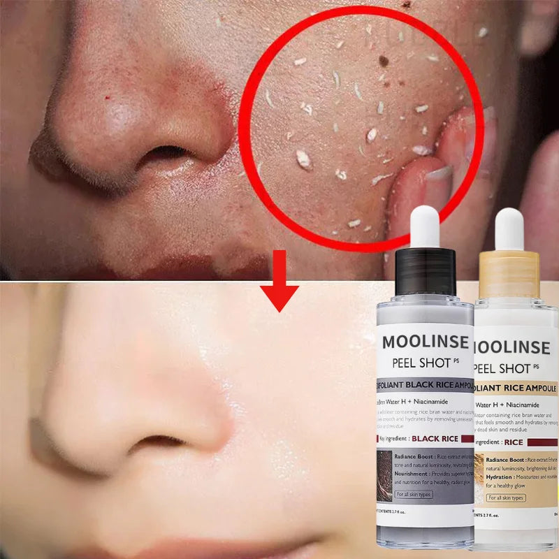 Korean White And Black Rice Exfoliating Serum