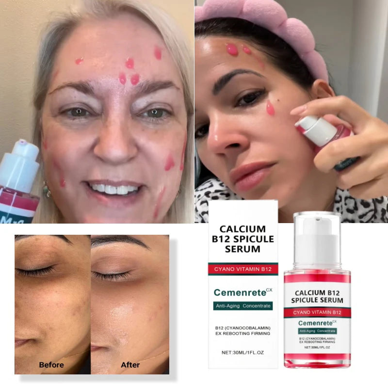 Pink Spicule Pore Tightening Anti-Aging Serum